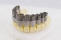 Industrie simple de For Dental Jewelry d'imprimante en métal du laser 3D de fibre