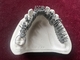 Impression titanique dentaire d'One Stop Denture de l'imprimante 3D d'alliage de chrome de cobalt