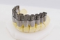 20μM High Speed Crown encadre l'art dentaire médical de Light Curing For de l'imprimante 3D